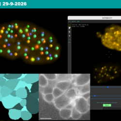 Webinar Huygens' AI Segmentation