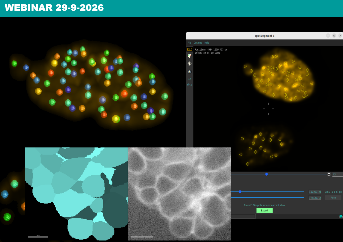 Webinar Huygens' AI Segmentation